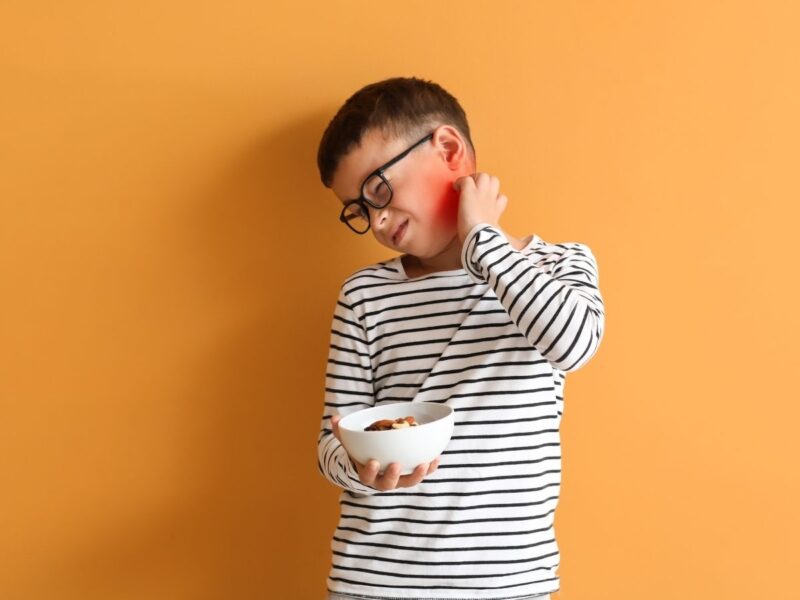 Bebek ve Çocuklarda Besin Alerjisi