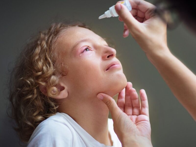 Bebek ve Çocuklarda Göz Alerjisi