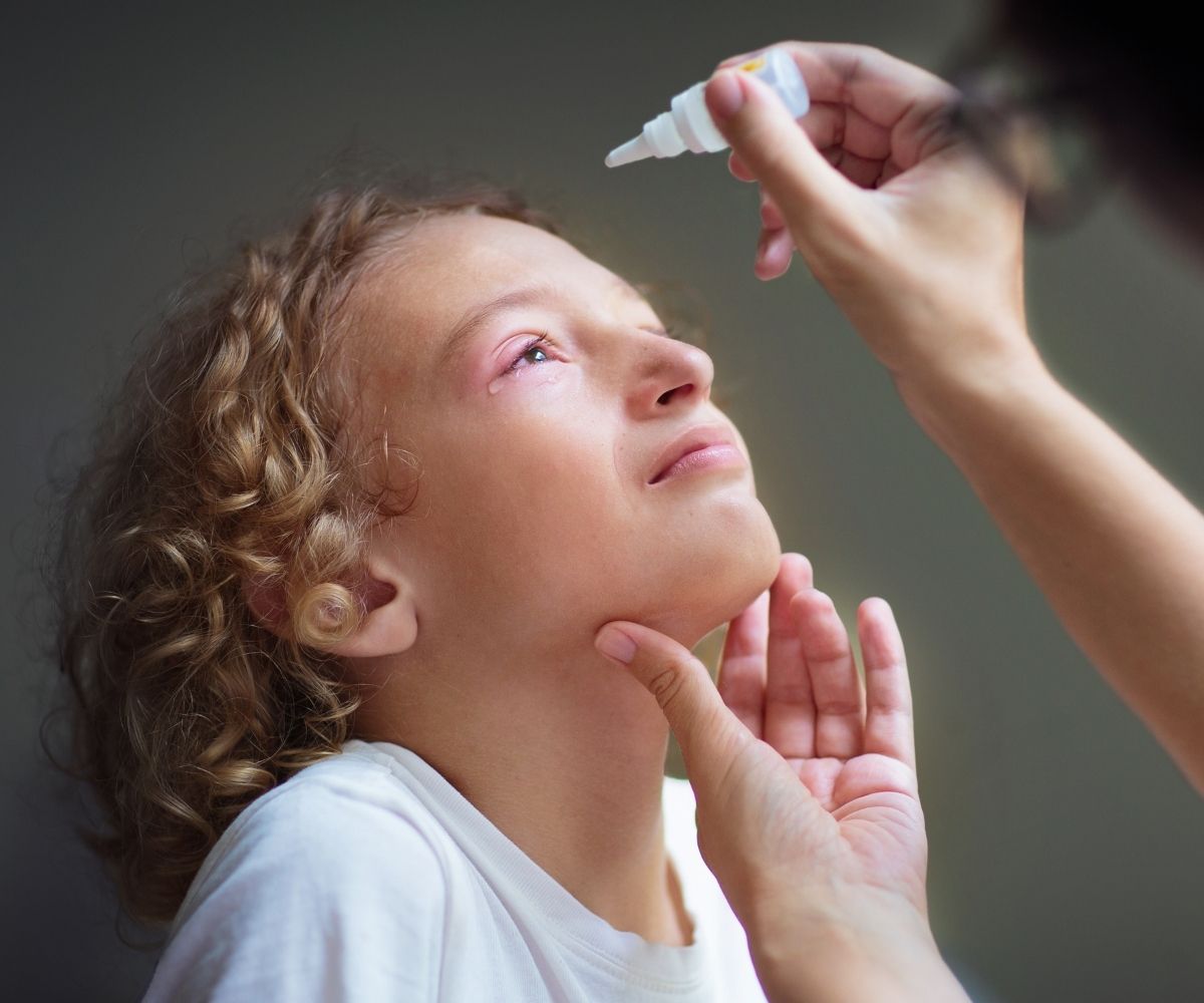 Bebek ve Çocuklarda Göz Alerjisi