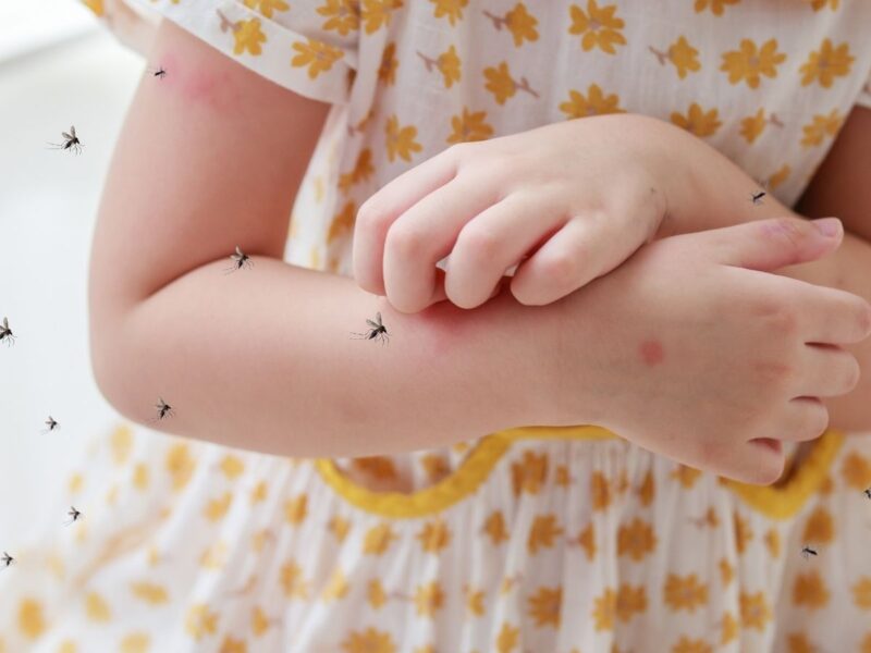 Bebek ve Çocuklarda Böcek Alerjisi