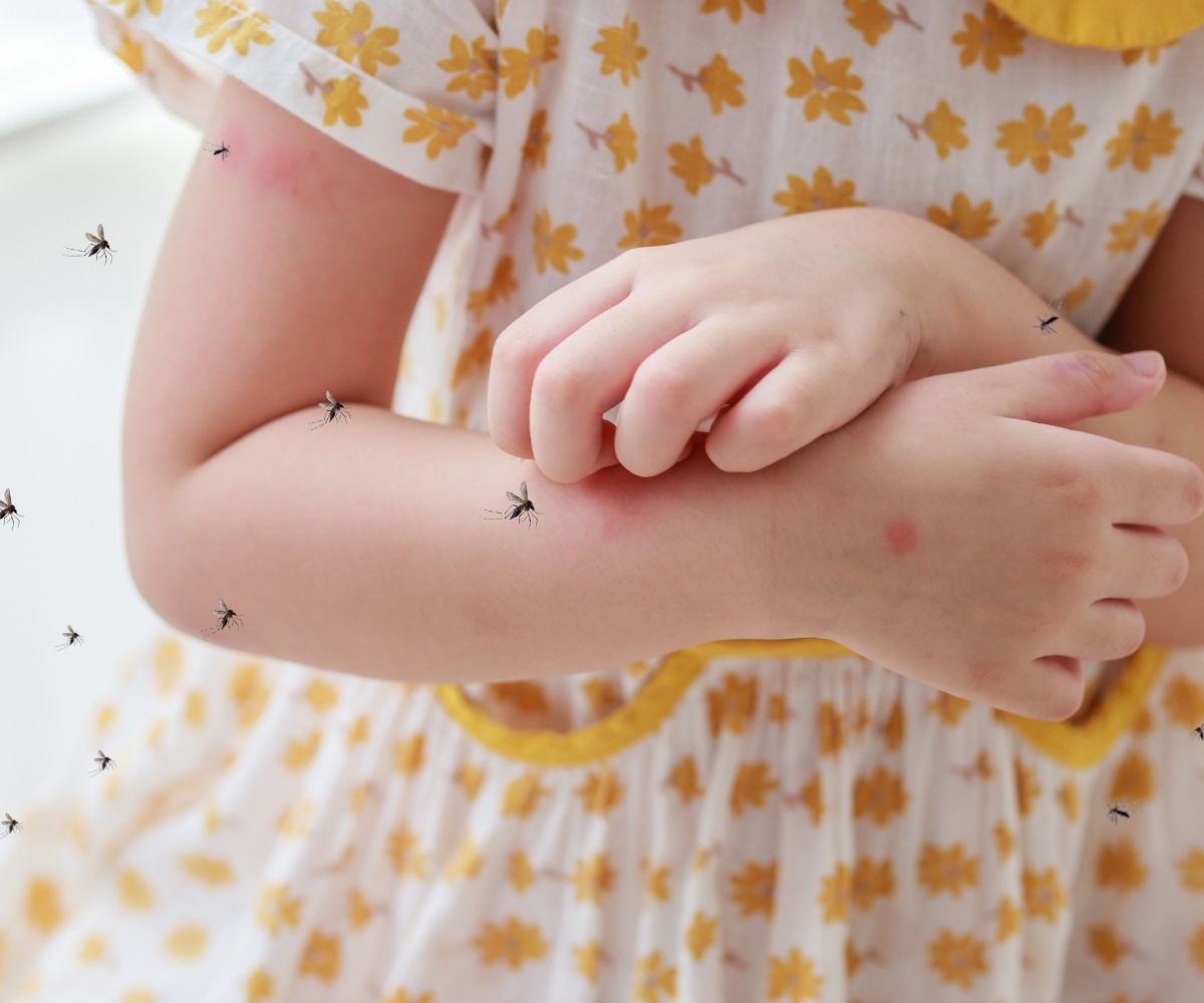 Bebek ve çocuklarda böcek alerjisi