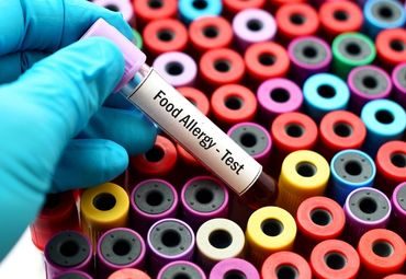 alerji testi